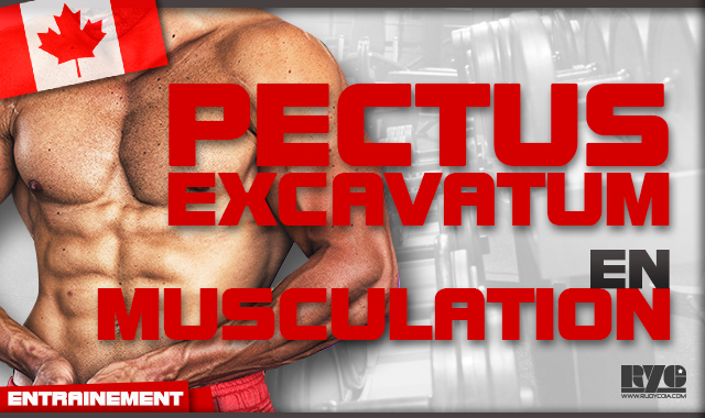 Que faire avec un Pectus Excavatum en musculation ?