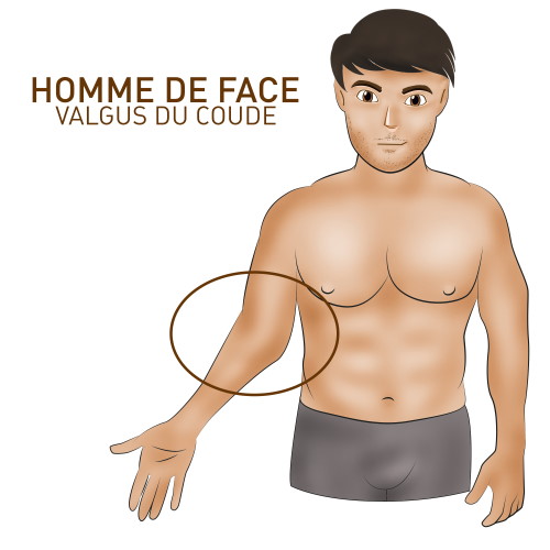 Valgus en musculation