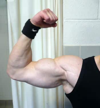 Exemple d'un biceps court